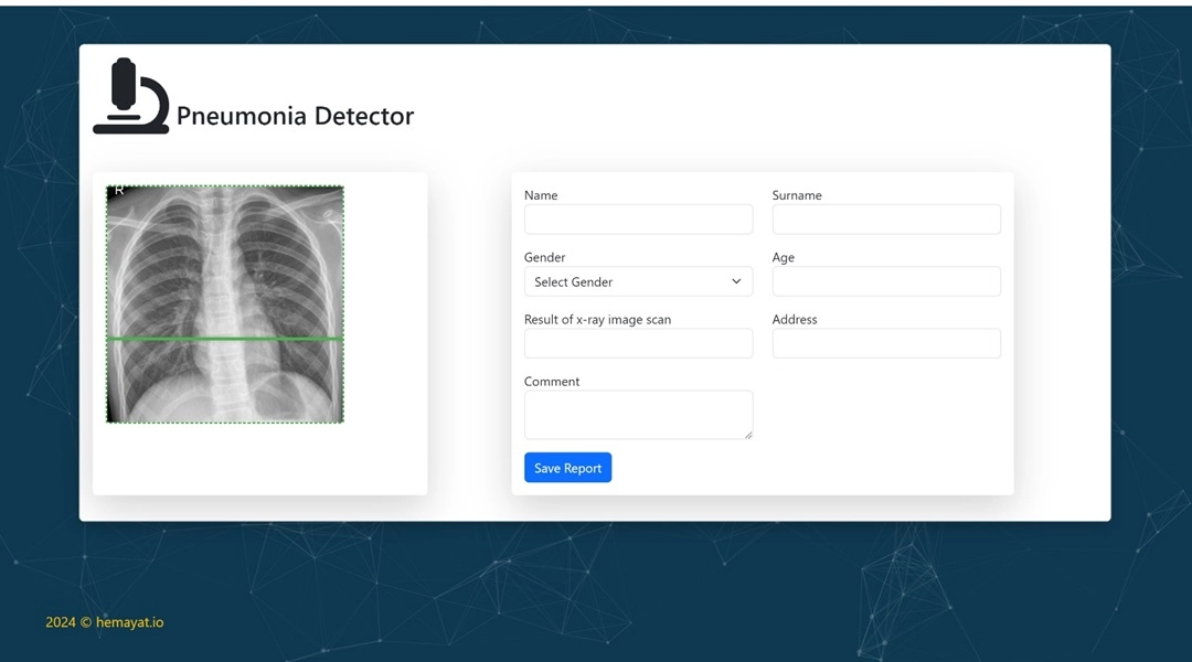 Pneumonia Detector - AI application